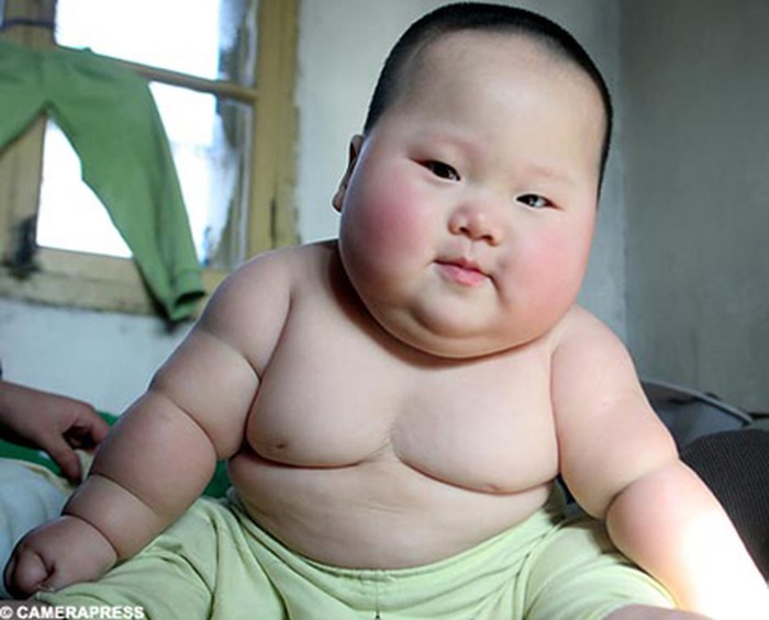 đủ mọi đối tượng mắc béo phì